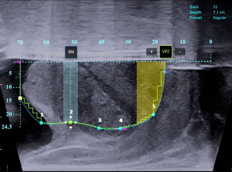 Contour Planning crop min 768x569